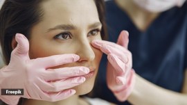 non surgical nose reshaping