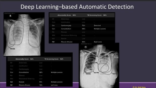 AI Cancer Detection