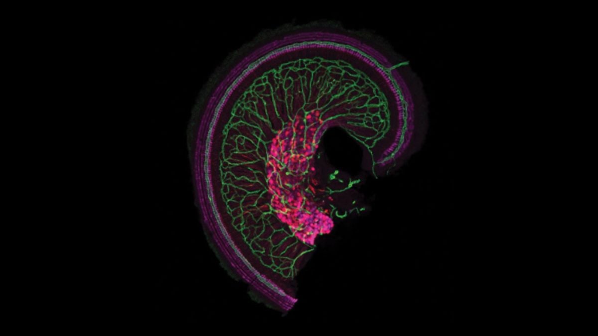 The snail-shaped cochlea of the inner ear