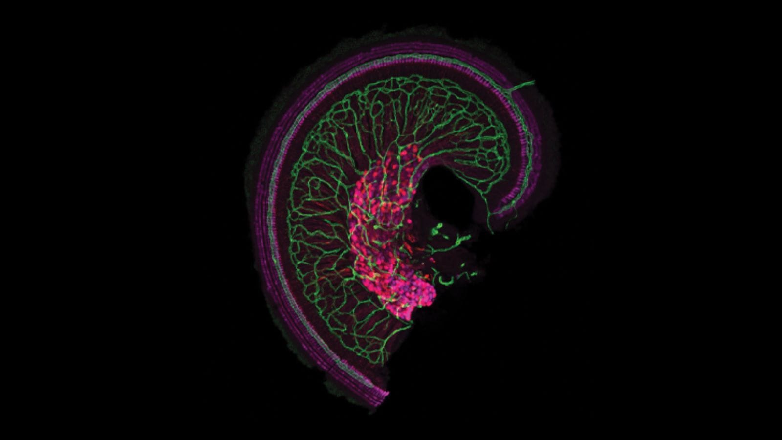 The snail-shaped cochlea of the inner ear