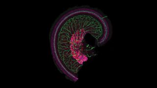 The snail-shaped cochlea of the inner ear