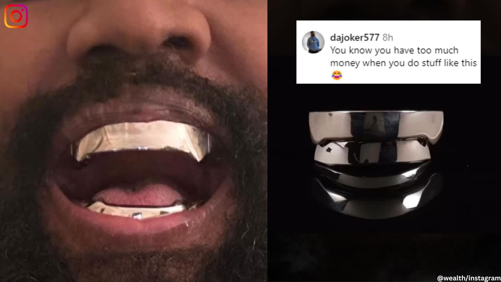 Kanye Wests New Teeth Grills 
