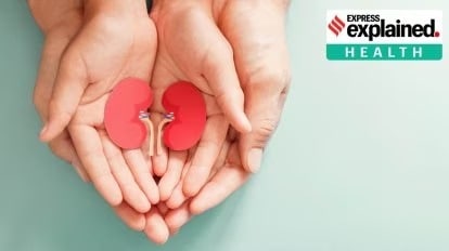 kidney transplant laws
