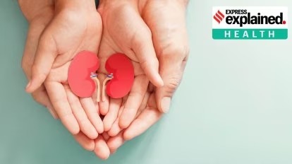 kidney transplant laws