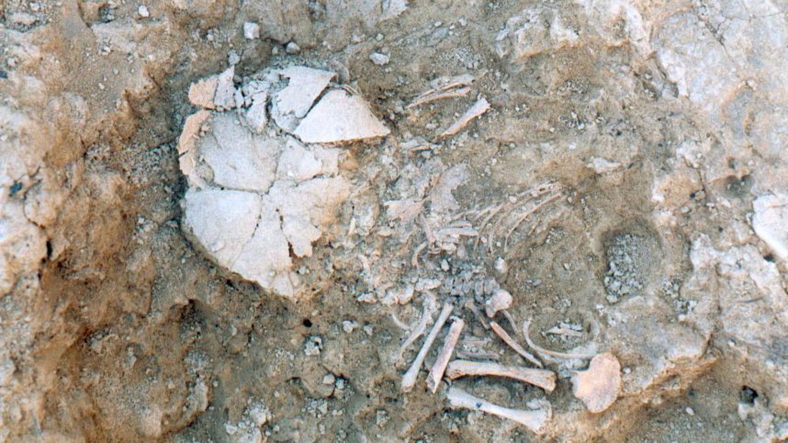 In an undated photo provided by Government of Navarre and J.L. Larrion, the inhumation of the prenatal infant with Down syndrome from the Iron Age site of Las Eretas. Scientists have diagnosed Down syndrome from DNA in the ancient bones of seven infants, one as old as 5,500 years.