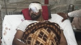 At least 3 farmers lost vision due to pellet injuries: Punjab health minister