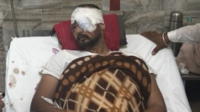 At least 3 farmers lost vision due to pellet injuries: Punjab health minister