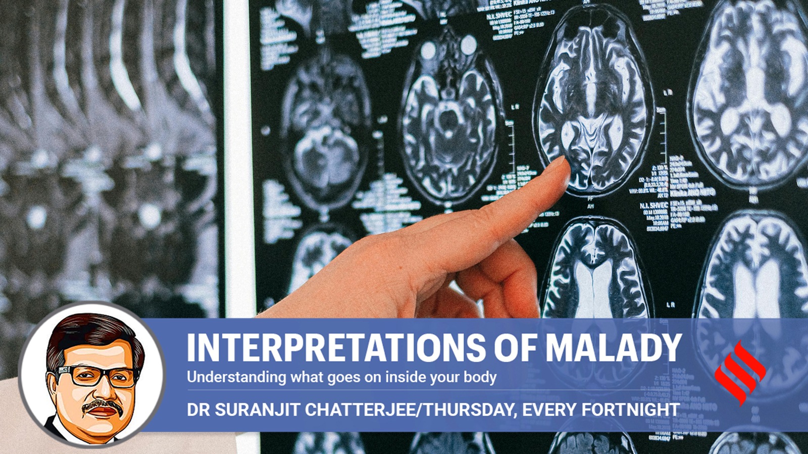 memory power, multivitamins, brain function, indian express