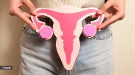 PCOS natural management, PCOS alternative treatment, PCOS cure without medication