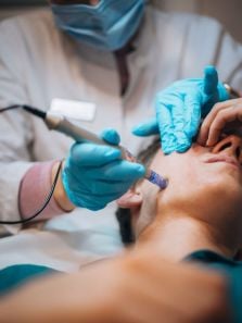 How to go about micro-needling treatment