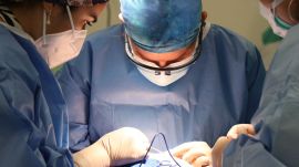 The surgery, led by Dr Anurag Garg, HOD Department of Cardiothoracic Surgery in DPU hospital, was completed within three hours of retrieving the organ.