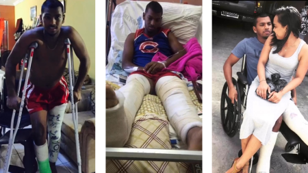 Nicholas Pooran underwent two surgeries and it took many months of rehab for him to get mobile on his feet again after the car crash.