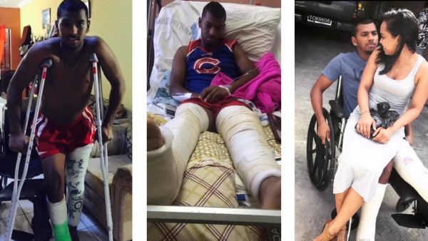 After the car crash, Nicholas Pooran underwent two surgeries and it took many months of rehab for him to get mobile on his feet again.