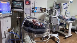 Rare Disease Day, Rare Disease policy, India Rare Disease policies, Rare Disease Organisation, Sleeping, what are rare decease, life-threatening decease, newborns, CCHS, deep sleep can be life-threatening, Congenital Central Hypoventilation Syndrome, round-the-clock ventilators, indian express news