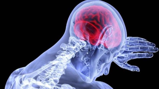 brain stroke, brain stroke survivor, stroke, how to overcome stroke, stress, anxiety, health and wellness, health news, brain, brain damage, indian express