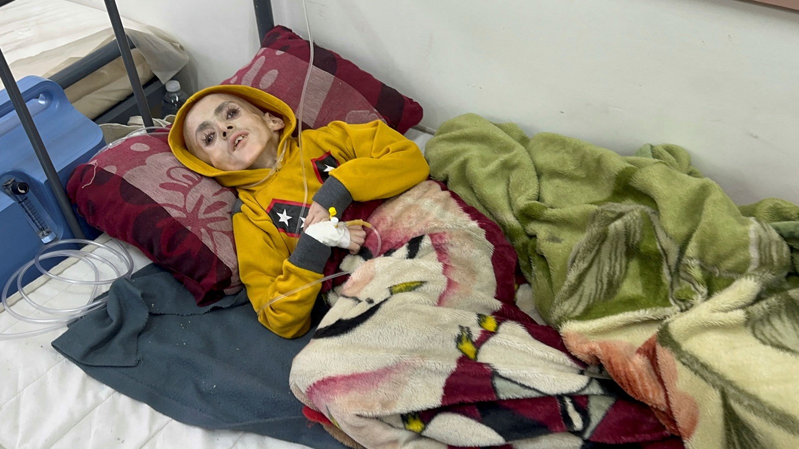The 10-year-old boy who has become the face of starvation in Gaza - Vimarsana News