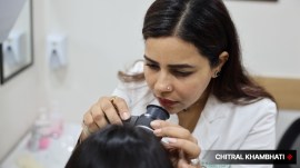 hair loss treatment, prp therapy, platelet rich plasma therapy