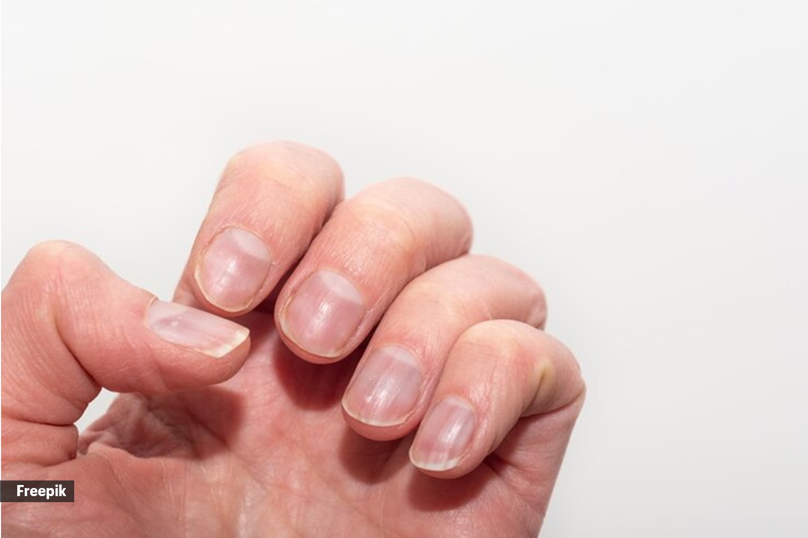 6 Reasons Why You Should Trim Your Nails Regularly