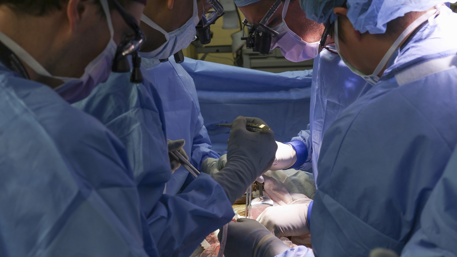 US surgeons have transplanted a pig kidney into a patient World News