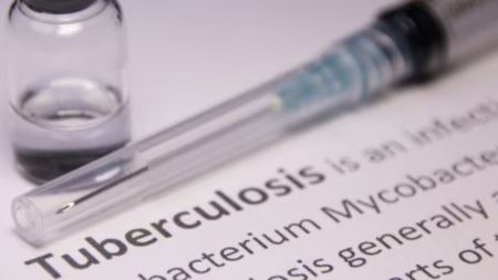 Lack of drug-susceptibility data for TB can compromise treatment outcomes: study