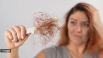 Myth or fact: Coffee may be a reason behind hair loss in women