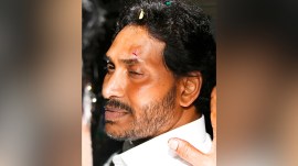 Andhra Pradesh Chief Minister YS Jagan Mohan Reddy with an injury on his left eye after a stone throwing incident during his Bus Siddam Yatra In Vijayawada, Saturday, April 13, 2024. (PTI Photo)