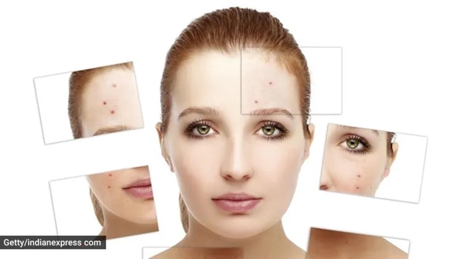 Tretinoin For The Skin Faqs Pros And Cons You Must Know About Life Style News The Indian