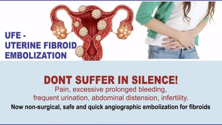 Do you suffer from painful periods? Don’t panic. Get yourself investigated!