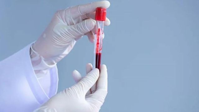Decoding the findings, Dr Manish Singhal, senior consultant, medical oncology, Indraprastha Apollo Hospitals, New Delhi says while some proteins are shed from cancer cells, the human body generates cancer cells daily and destroys them too