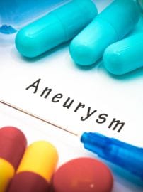 Can Aneurysm be prevented