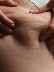 Here’s how you can get rid of butt acne