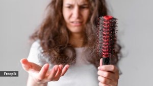 hair loss, hair thinning. tretinoin