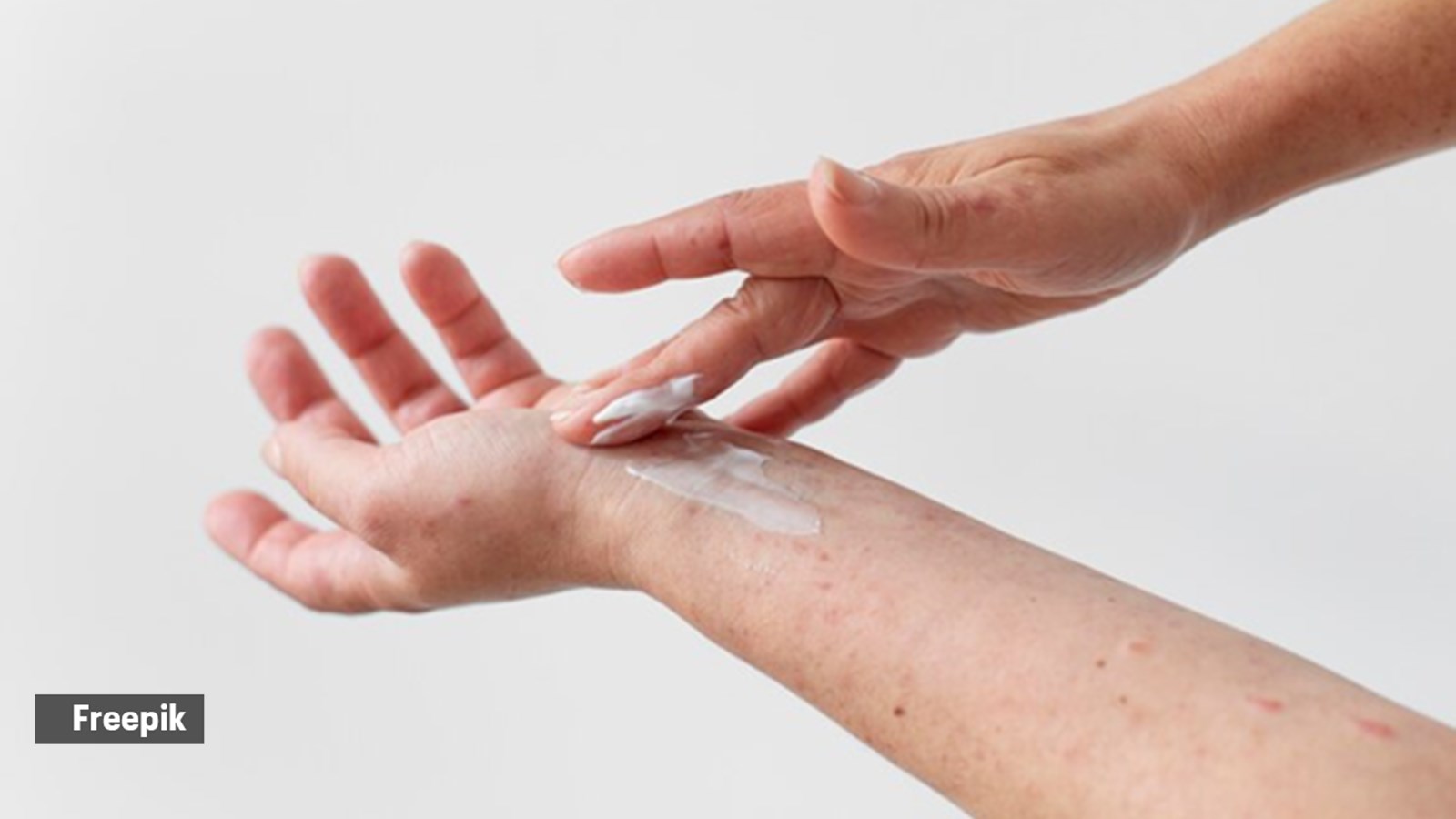 Can the viral arm basting trick help get rid of keratosis pilaris