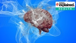 Alzheimer's treatment