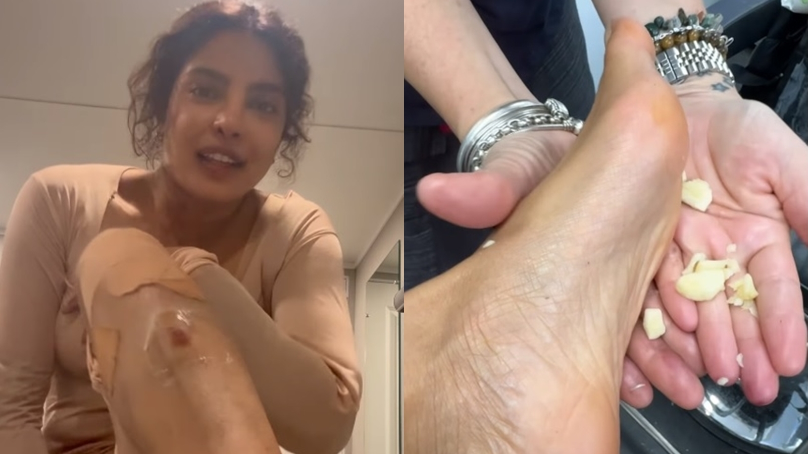 Priyanka Chopra tries Indian 'nuskha' of rubbing garlic on feet after  suffering injuries on film set in Australia. See pics, videos | Bollywood  News - The Indian Express