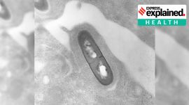 Listeria