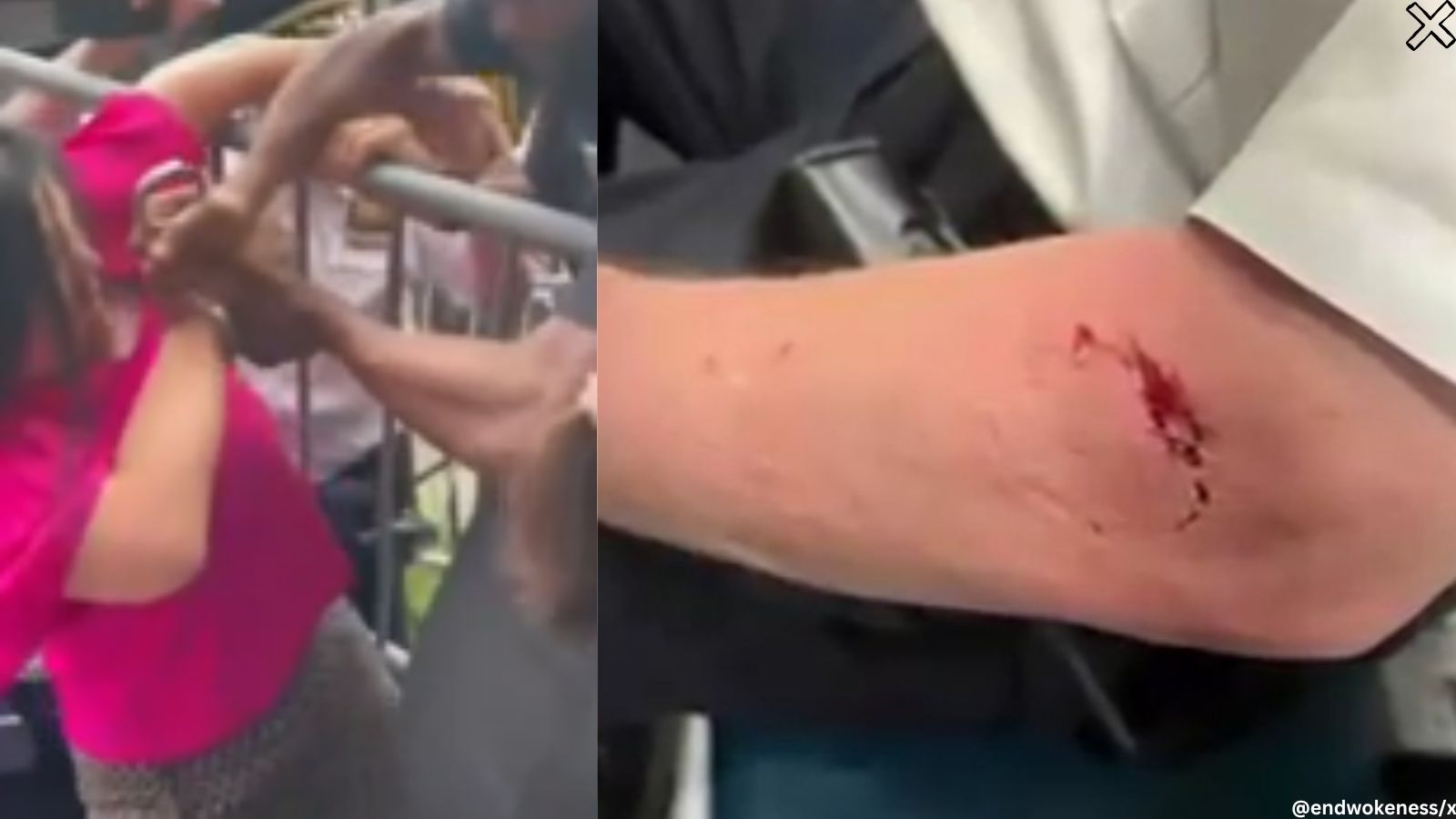 WATCH: New York City Council member ‘bites’ NYPD cop during protest ...