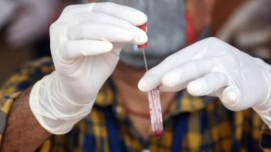 Chandipura virus (CHPV): Typical symptoms include a rapid onset of fever, vomiting, altered mental state, convulsions, diarrhoea, neurological deficits, and signs of meningeal irritation.