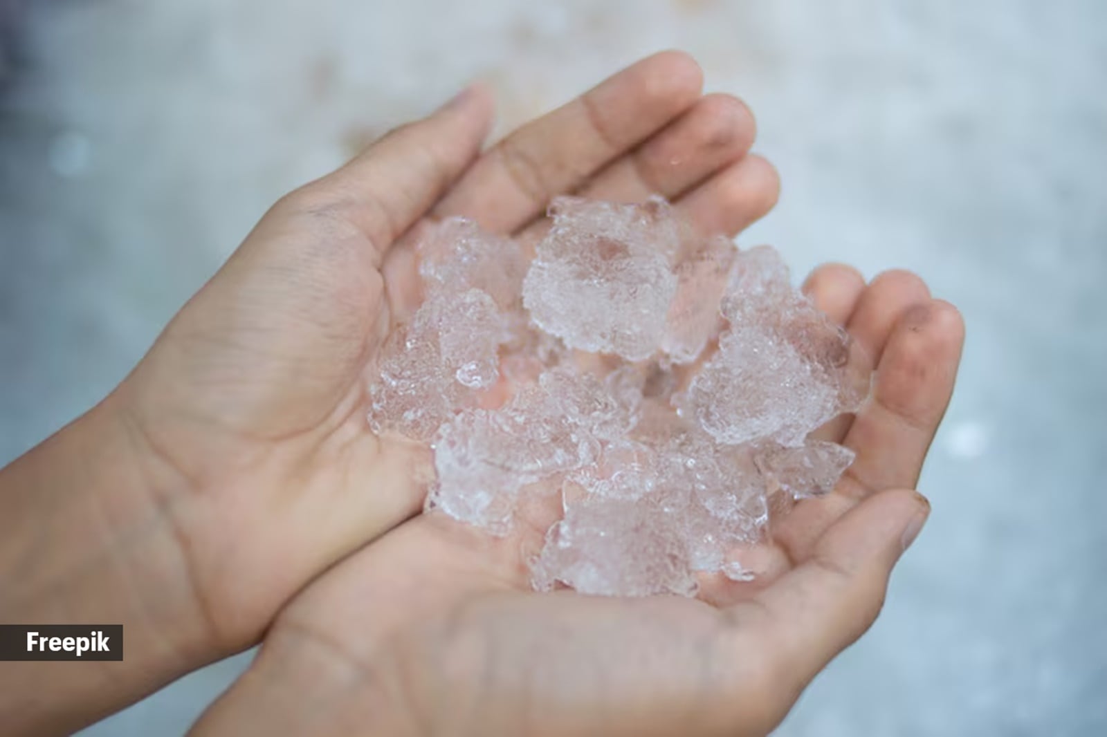 जले पर बर्फ लगाना