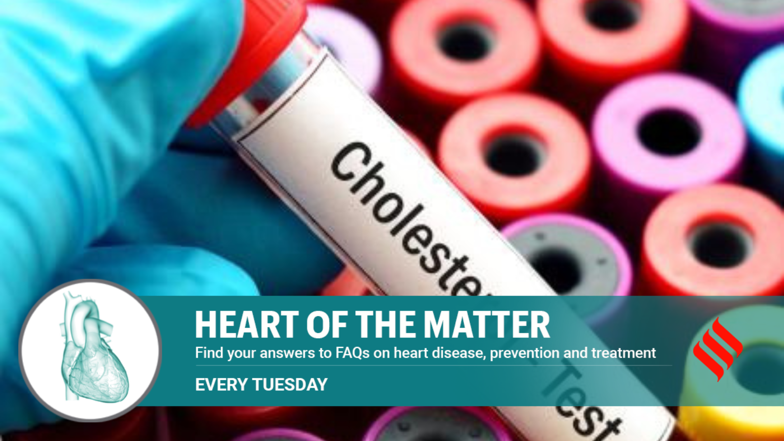 Does cholesterol give out warning signs? Here’s what happens
