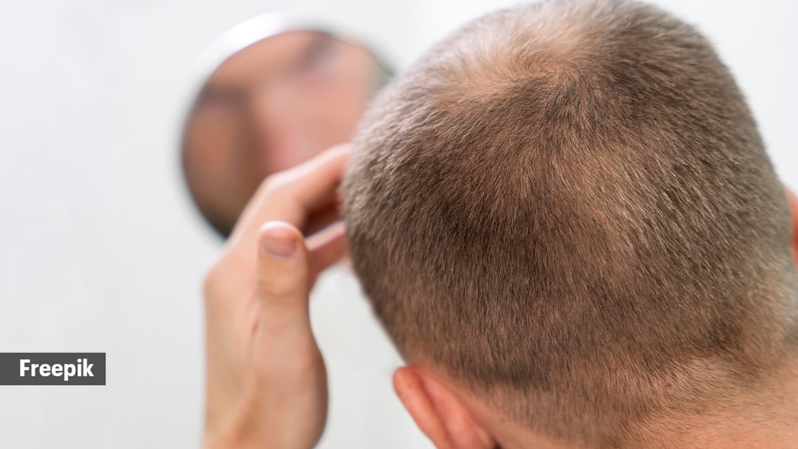 Balding got you down? Dermatologist says this ‘hair tattoo’ can help