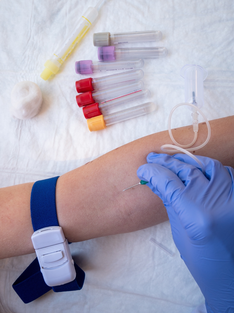 The dangers of bloodletting: Why athletes should avoid this extreme measure