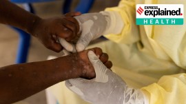 Why latest mpox outbreak is ‘emergency of international concern’
