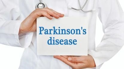 Can Parkinson's symptoms be cut by half? AI-powered brain therapy offers hope