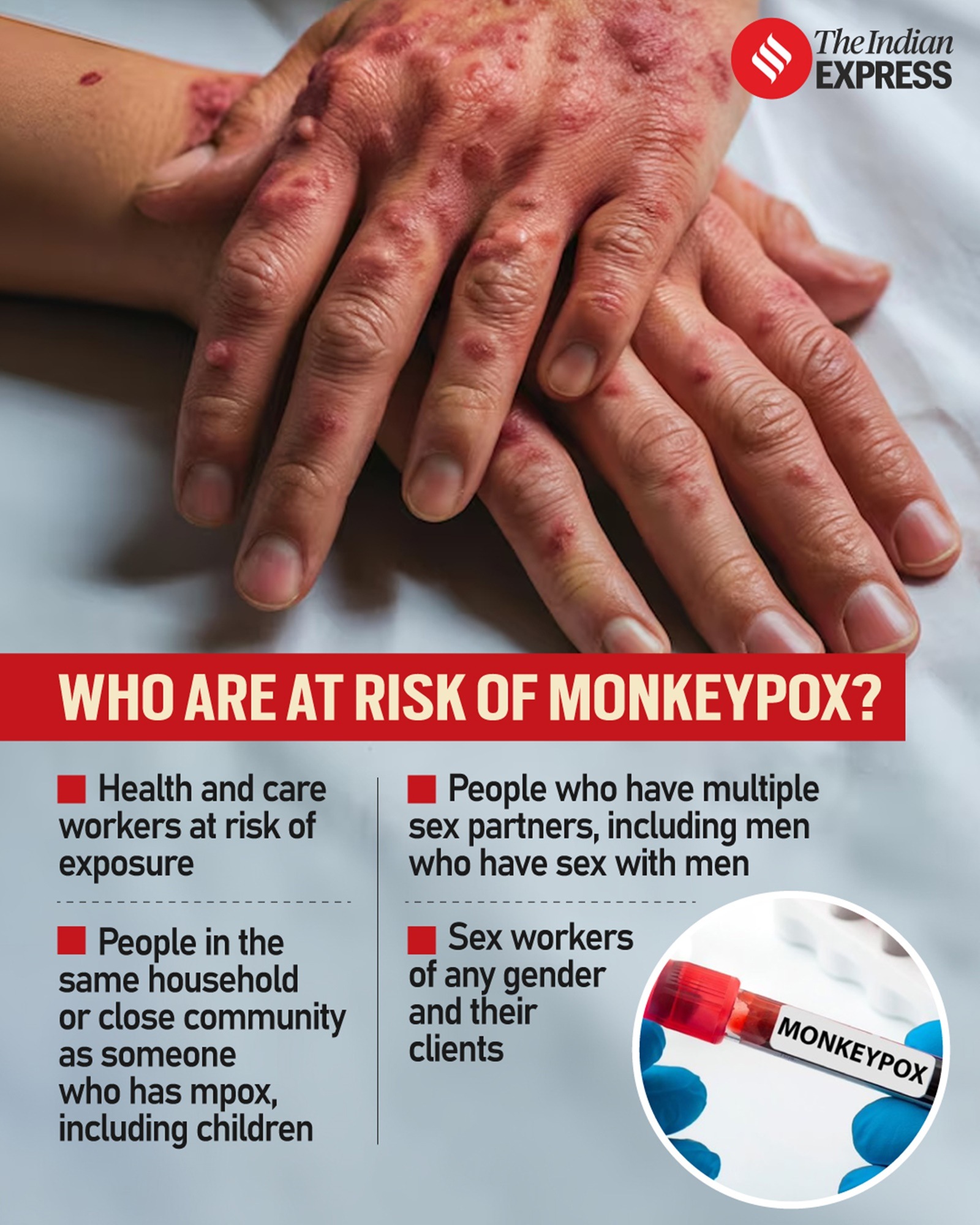 Monkeypox virus has struck Africa again, leaving continent scrambling ...