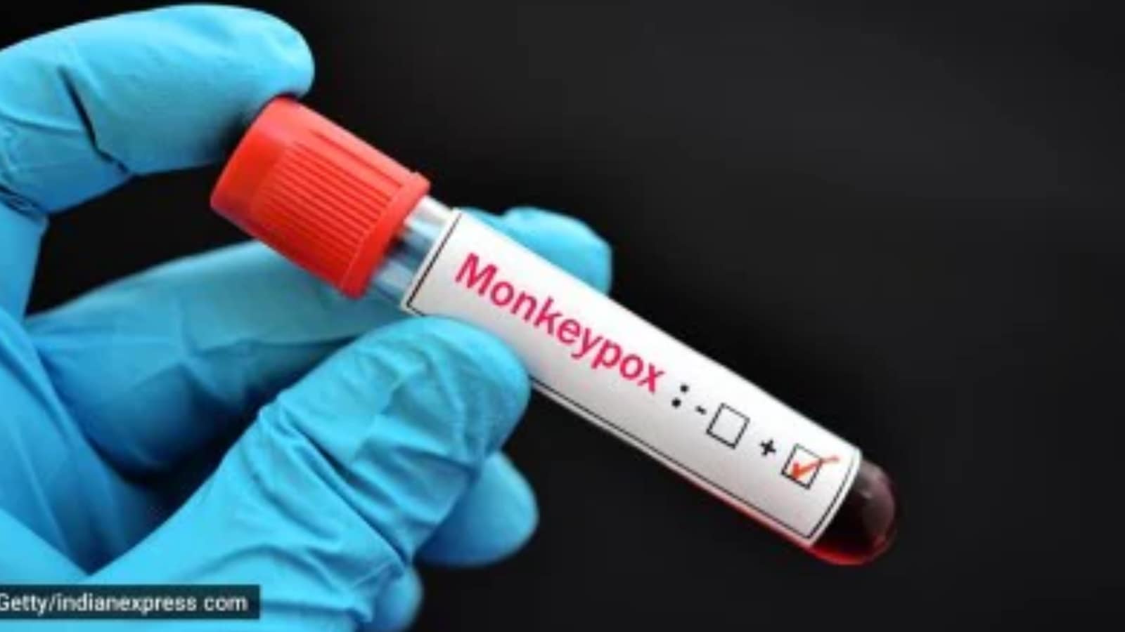 Mpox outbreak risk low, keeping eye on travellers Health Ministry