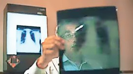 Tuberculosis, tuberculosis cases, tuberculosis patient, Pune news, Pune news, Maharashtra news, Indian express news