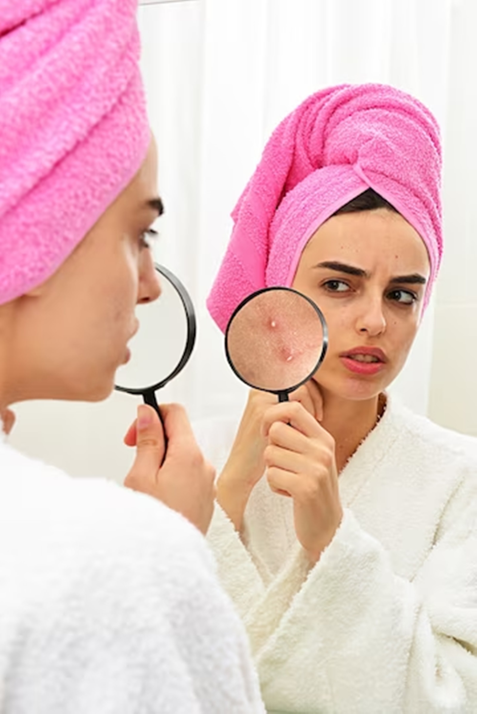 UV rays can thicken the outer layer of the skin, trapping sebum and bacteria in pores, which can lead to more breakouts.