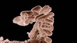 E.Coli, bleaching powder, Greater Noida housing society, water samples, water contamination, coliform bacteria, bleach, sick residents, greater noida, housing society, Indian express news