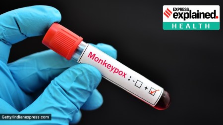 monkey pox, monkey pox vaccines, arrival of mpox, mpox origin, Democratic Republic of Congo, mpox outbreak epicentre, mpox vaccines donation, Mpox cases, indian express news, explained, health explained, current affairs
